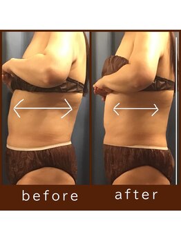 エクレボーテ(ECOULERBEAUTE)/リンパアビヤンガ