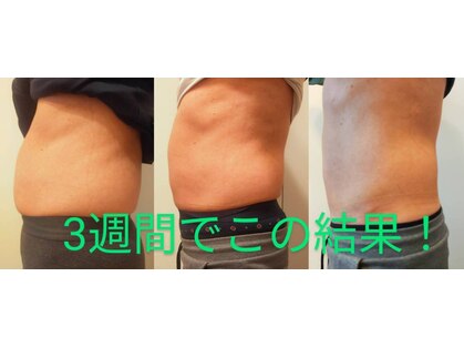 エムアールエイチ ウィズピービーピー(MRH withPBP)の写真