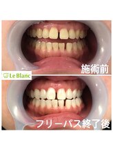 ルブラン 奈良店(Le Blanc)/楽しく通って頂きました！