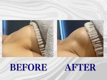 ザモア 福岡天神(THE MORE)/【症例 Before After】