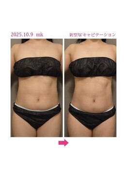 サロン ド 花歩 松山本店/新型Wキャビ１回の結果