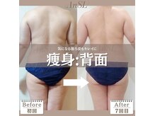 アンスル 那覇(AnSL)