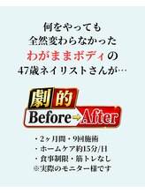 バストラボ 仙台店/47歳わがままボディさんの場合☆