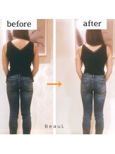 ビュール 銀座(BeauL)/美容矯正