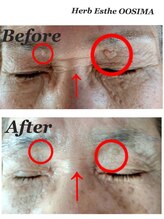 リコリナ(LikoLina)/ホームケア商品