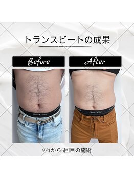 オフ(off)/痩身ビフォーアフター