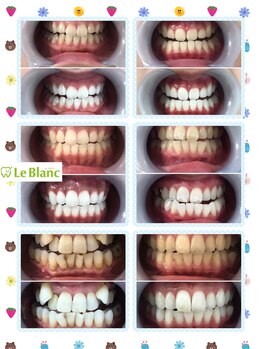 ルブラン 奈良店(Le Blanc)/たったの3週間です!