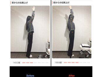 鹿児島整体院/猫背/骨盤矯正/鹿児島/整体