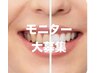 限定3名！好評につき復活モニター募集！3ヶ月通い放題セルフホワイトニング