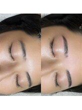 レアファースト 天神/レアファースト