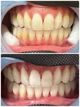 ハモットホワイト(Hamotto White)/照射5日目☆