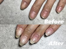 結(Yui)/自爪育成 Before→After