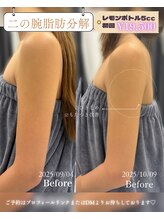 クレビア(CREBIA)/二の腕、そのままでいいの？