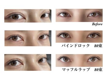 レシェリマ(Lesherima)/次世代バインドロック