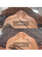 美身庵(Bishinan)/姿勢を改善して小顔へと導く施術