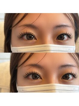 ヨルン(yorn)/エクステ