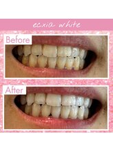セルフホワイトニングサロン　エクシアホワイトニング熊谷店【4/1 OPEN（予定）】/