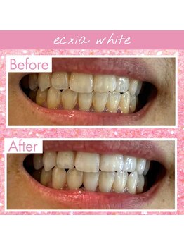 セルフホワイトニングサロン エクシアホワイトニング熊谷店【4/1 OPEN(予定)】/