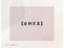 シェーン(Schon)/Before→Afterのお写真