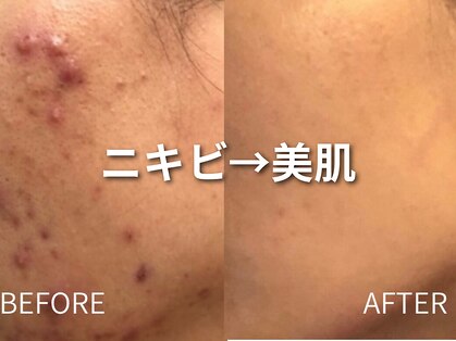 ラポール 野並店(Rapport)の写真