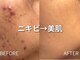 ラポール 野並店(Rapport)の写真