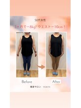 ヴェリテ(Verite)/before after　50代
