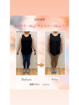 ヴェリテ(Verite)/before after 50代