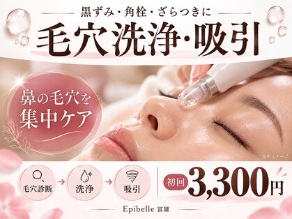 エピベル(Epibelle)の写真