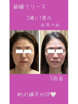 サロン ド スー(Salon de Suu)/ウルトランスフォーマー