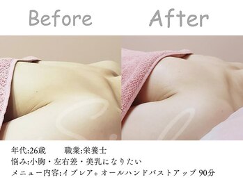 シエル(Siele)/美容クリニックに頼らずバストUP