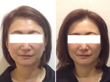 美容整体 ウェリナ 蟹江院/小顔矯正/骨盤矯正/美脚サロン