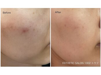 1002(トウフ)/BEFORE/AFTER 