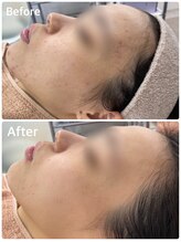 スハダビ110(suhadabi110)/before　after