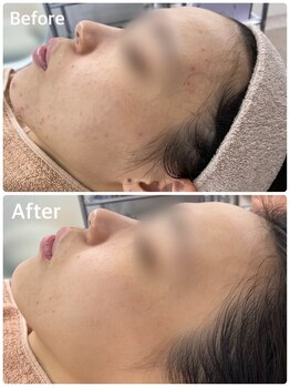 スハダビ110(suhadabi110)/before after