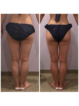 ナレル(narrel)/(新潟市/骨盤/痩身/ダイエット)