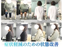 整体院 ワン(ONE)の雰囲気（施術による変化の一例となります。）