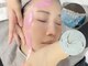 クリード(CLEAD)の写真/【フェイシャルワックス×最新美容脱毛】産毛レスでつるんとたまご肌♪正しいお顔の産毛ケアで化粧ノリUP!