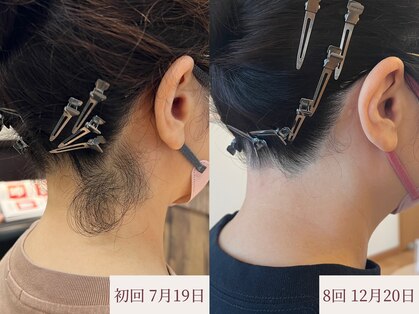 クラームビューティー(Clerm beauty)の写真
