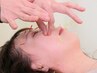 【初回限定】美容鍼60分 4980円