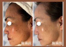 サンラックスサロン 岐阜(SANlux Salon)