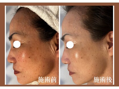 サンラックスサロン 岐阜(SANlux Salon)の写真
