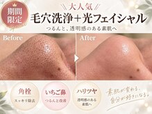 ラカ 川中島店(LaKa)の雰囲気（9月限定★毛穴・たるみケア♪毛穴開き徹底ケア！）