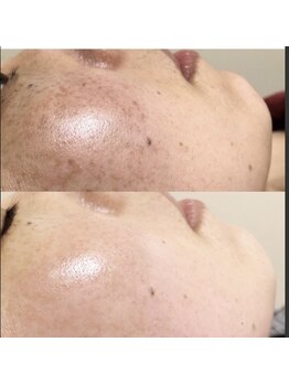 アルページュ(Arpege)/美肌の極み★リアボーテハーブ3g