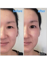 エステティック らぽーる(Rapport)/超級小顔♪奇跡の表情筋ケア