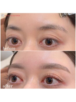 ビビデバビデ(Vivide Vavide)/不動の人気1位・同時施術コース