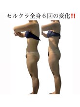 痩身革命 大宮店/ダイエットリンパマッサージ