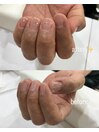 リペア