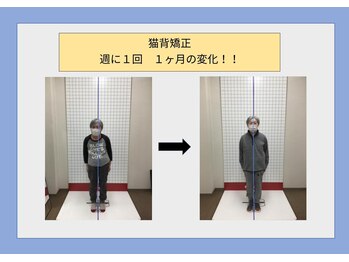 ほねつぎ長嶺鍼灸接骨院/ビフォーアフター6