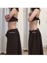 ジョワイユ(Joyeux)/腸の位置でお腹は変わる