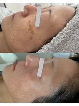 イーサロン(eii salon)/40代　女性